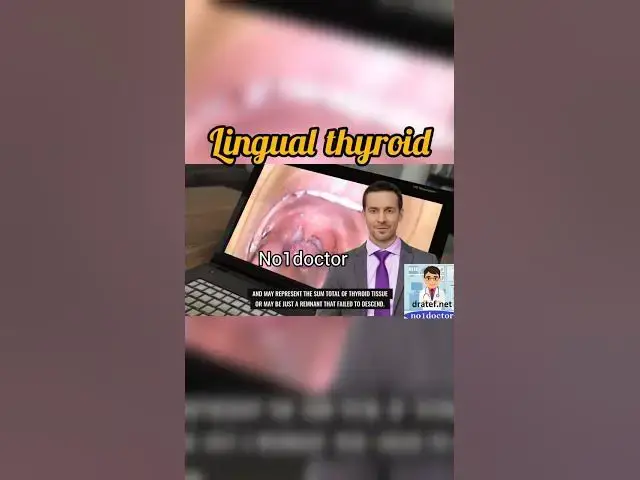 Video thumbnail for #lingual_thyroid #shorts #thyroid #hypothyroidism #thyroidhealing #thyroidcancer #thyroidhealth