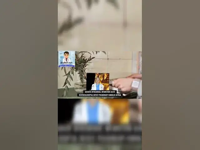 Video thumbnail for Causes of cardiogenic shock