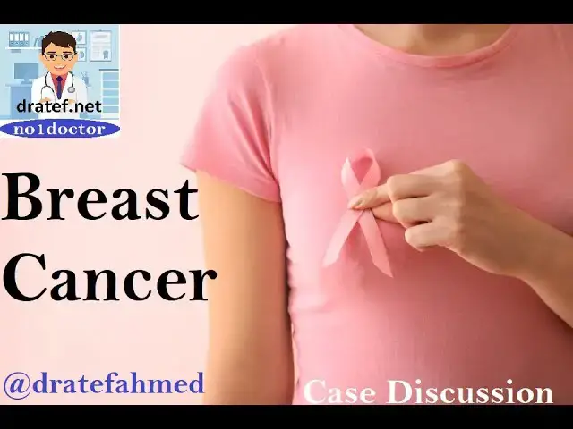 'Video thumbnail for Breast Cancer /Medical Exame/ Medical Case Disscussion/ Surgical &Non Surgical ttt of Breast Cancer'