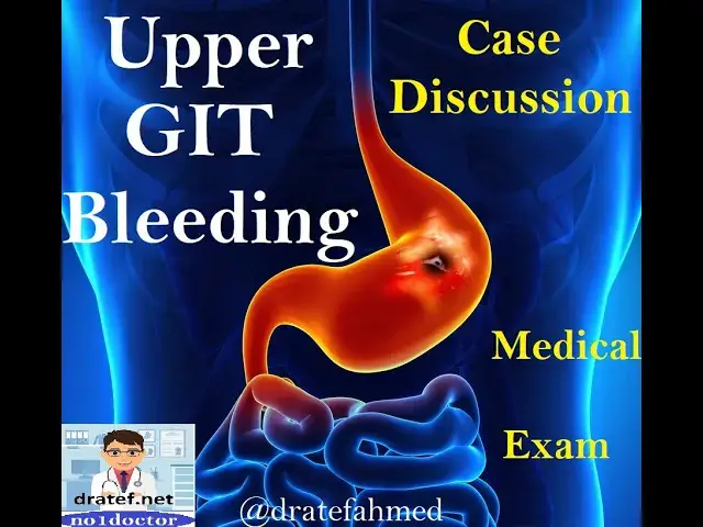 'Video thumbnail for Upper GIT Bleeding / Medical Exam / Medical Case Discussion / Surgical & Non Surgical Treatment'