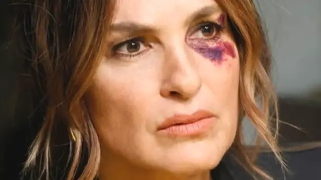 Video thumbnail for Actors Who Suffered On-Set Injuries That Ended Up In The Show