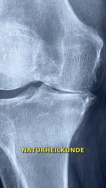 Video thumbnail for VAMED Klinik Bad Berleburg: Spezialisierte Gesundheitsversorgung im Rothaargebirge