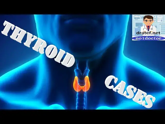 Video thumbnail for Thyroid Cases Atlas /Thyroid Diseases/Thyroid Problems/ Thyroid Surgery/ No1doctor/ dratef /Mrcs