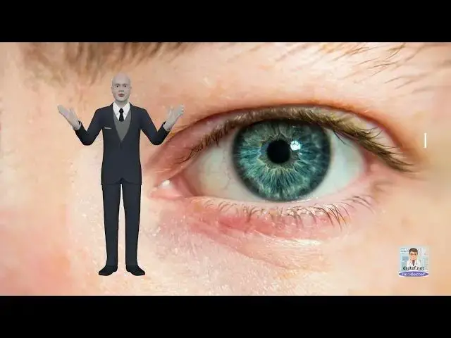 Video thumbnail for Cataract