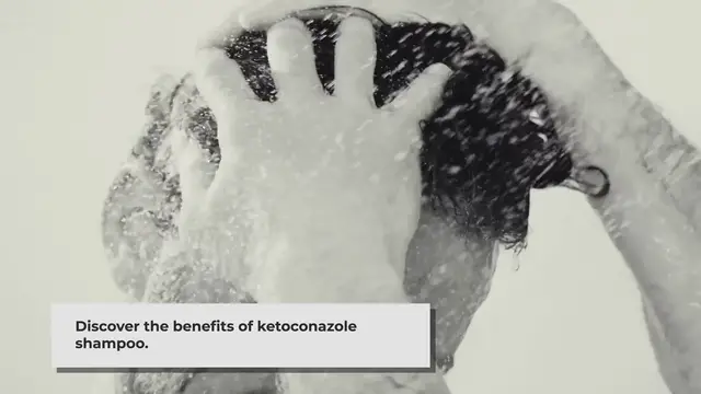 'Video thumbnail for Ketoconazole Shampoo Benefits and Side Effects Explained'