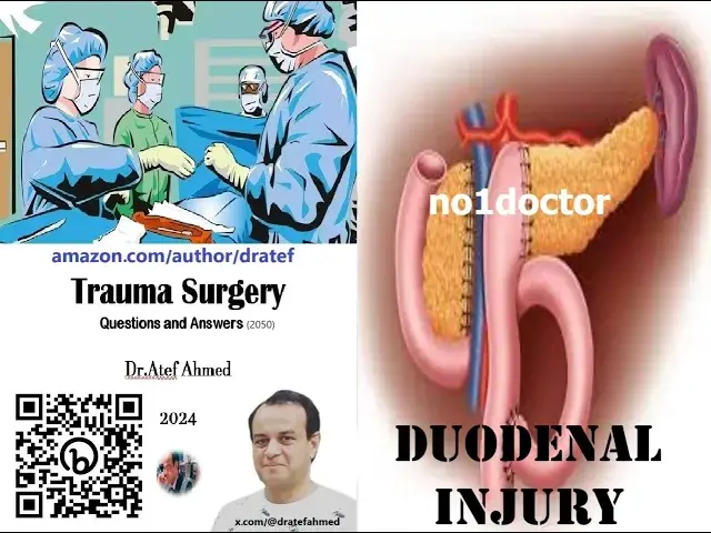 Video thumbnail for Duodenal Injury  A Multidisciplinary Approach to Diagnosis and Management #duodenalinjury #medicine