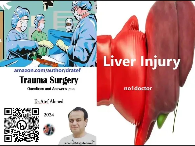 Video thumbnail for Liver Injury  A Comprehensive Guide for Medical Professionals #liverinjury #medicine #medicaleducati