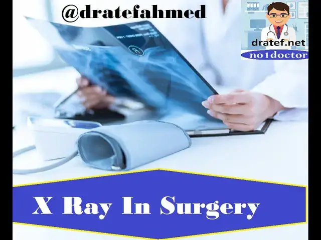 Video thumbnail for X Ray In Surgery / Chest X Ray /  Abdominal X Ray / How To Read X Ray / X Ray Lecture / X Ray Tips