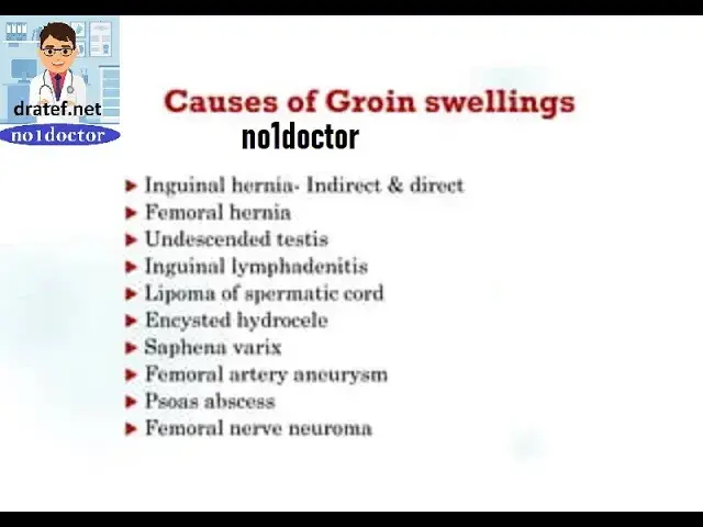 Video thumbnail for Groin Swelling /Inguinal Hernia /Femoral Hernia/lymph node / Abscess / Cyst /Lipoma /Hydrocele
