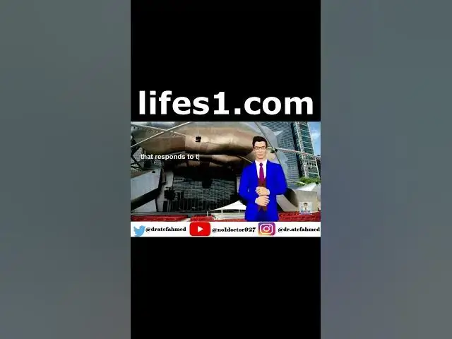 Video thumbnail for Wilson Syndrome  #medicalsyndrome #syndromes #shorts  #Mrcs  #Frcs #Usmle  #medicalstudents