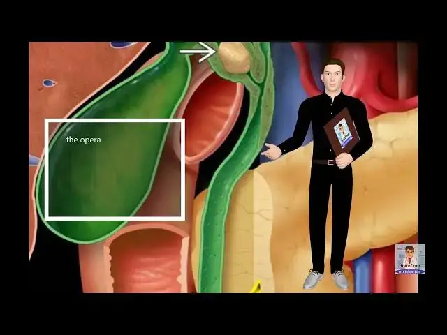 Video thumbnail for Mirizzi syndrome 2