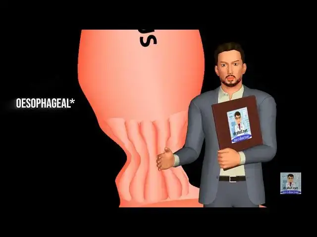 Video thumbnail for Achalasia