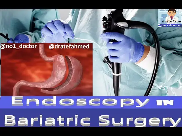 Video thumbnail for Endoscopy in Bariatric Surgery Endoscopy Before and After Bariatric Surgery /Bariatric Complications