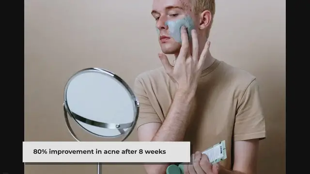 'Video thumbnail for niacinamide'