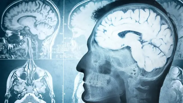 Video thumbnail for The Strangest Things Your Brain Does