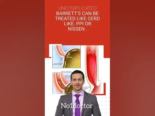 Video thumbnail for #Barret_esophagus #GERD #reflux #cancer #esophagus #shorts #no1doctor #medical#usmle #frcs #dratef