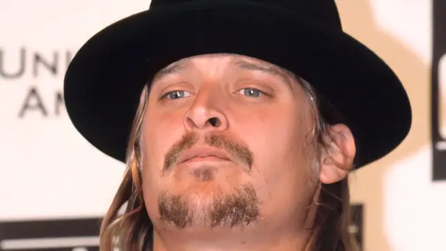 'Video thumbnail for Kid Rock's Transformation Has Our Jaws On The Floor'