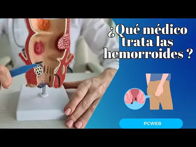 Video thumbnail for ¿Qué médico trata las hemorroides y cuándo deberías consultarlo?