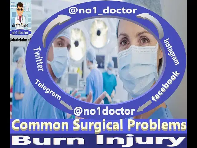Video thumbnail for Burn Injury /Surgical Problems/Management of Burn /No1doctor /dratef /Mrcs /Frcs/Usmle