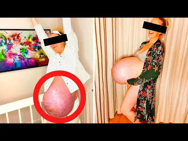 Video thumbnail for Doctor Shocked When He Found Out Why This Pregnant Woman Baby Bump Was Strangely Huge !