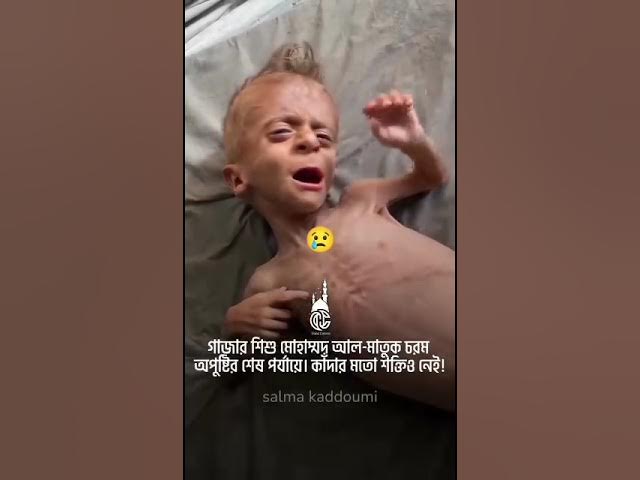 Video thumbnail for #world #share 😭