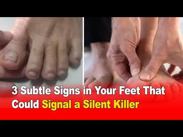 Video thumbnail for 3 Subtle Signs in Your Feet That Could Signal a Silent Killer 🦶⚠️