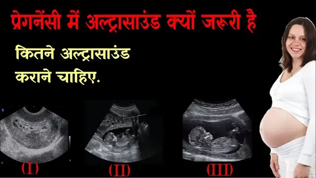 Video thumbnail for Pregnancy me ultrasound kab karna chahiye | Baby ultrasound in pregnancy | Pregnancy and Care