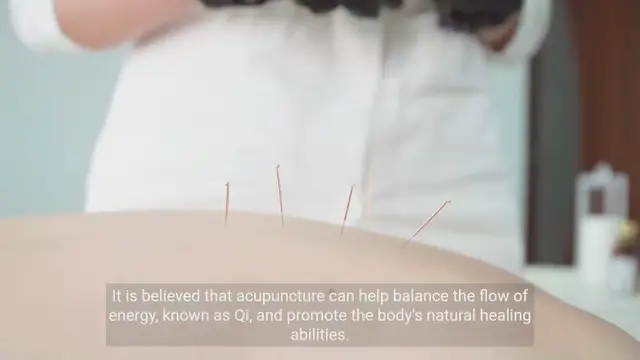 Video thumbnail for Unlocking the Power of Acupuncture: Discover its Potential