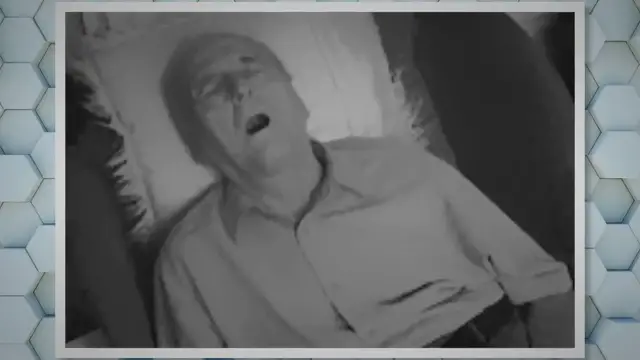 Video thumbnail for Best Chin Strap for Mouth Breathers