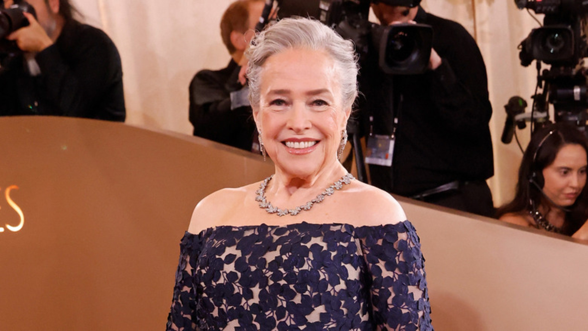 Video thumbnail for Before & After Photos Of Kathy Bates' Ozempic Face Are Jarring