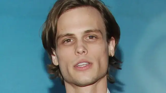 Video thumbnail for What We Know About Matthew Gray Gubler's Health Issues