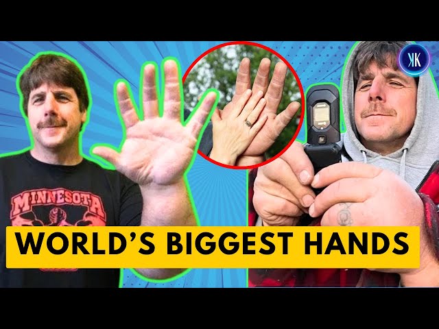 Video thumbnail for He Has The BIGGEST Hands In The World!