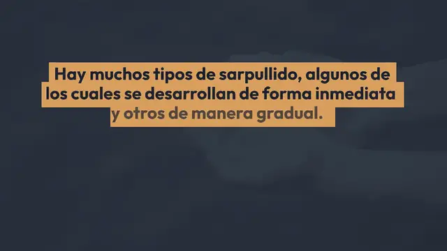 Video thumbnail for 5 remedios de uso externo para calmar el sarpullido