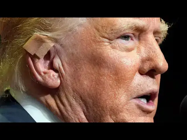 Video thumbnail for Trump's Doctor Gives Startling Update After Attack