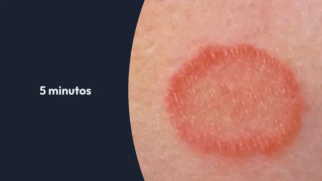 Video thumbnail for El aceite del árbol del té: el aceite de la vida y de los mil remedios