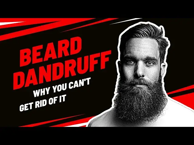 'Video thumbnail for The 5 Reasons Why You Have Beard Dandruff'