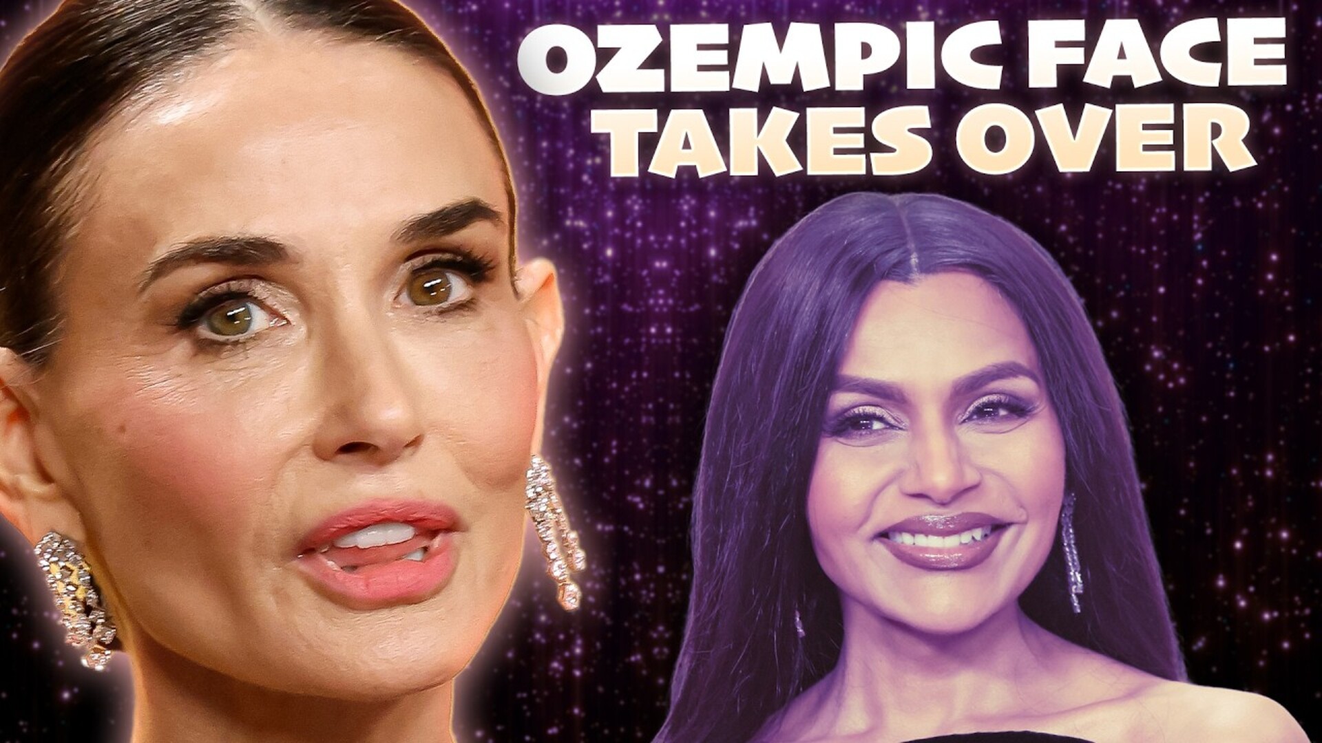 Video thumbnail for "Ozempic Face" Takes Over The 2026 Actors Awards And Viewers Are Worried