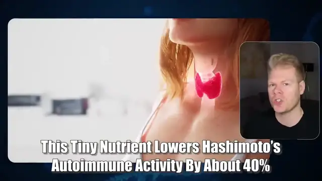 Video thumbnail for A Tiny Dose Of This Is The Secret To Healing Hashimoto s Naturally(720P HD)