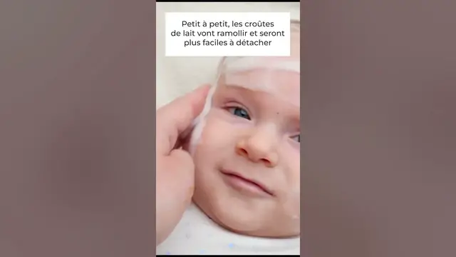 'Video thumbnail for 👶 Croutes de lait : comment s'en débarrasser ?🍼'