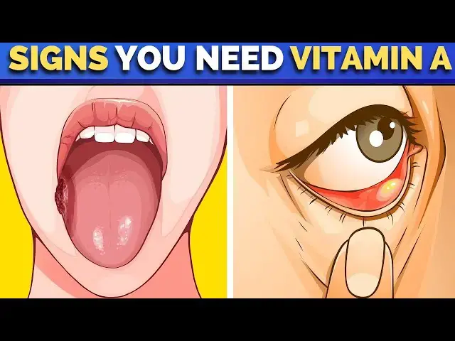 'Video thumbnail for EARLY WARNING SIGNS Your Body Is In Need Of Vitamin A'
