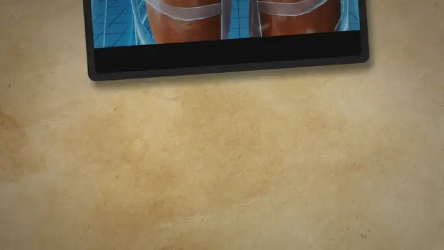 'Video thumbnail for Natural Solutions for Varicose Veins: Unveiling the Power of Herbal Remedies'