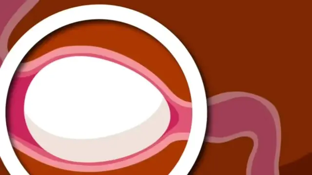 Video thumbnail for How EGGS Are Formed Inside The Chicken