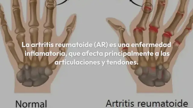 Video thumbnail for Alivia el dolor de artritis en las manos con 8 ejercicios