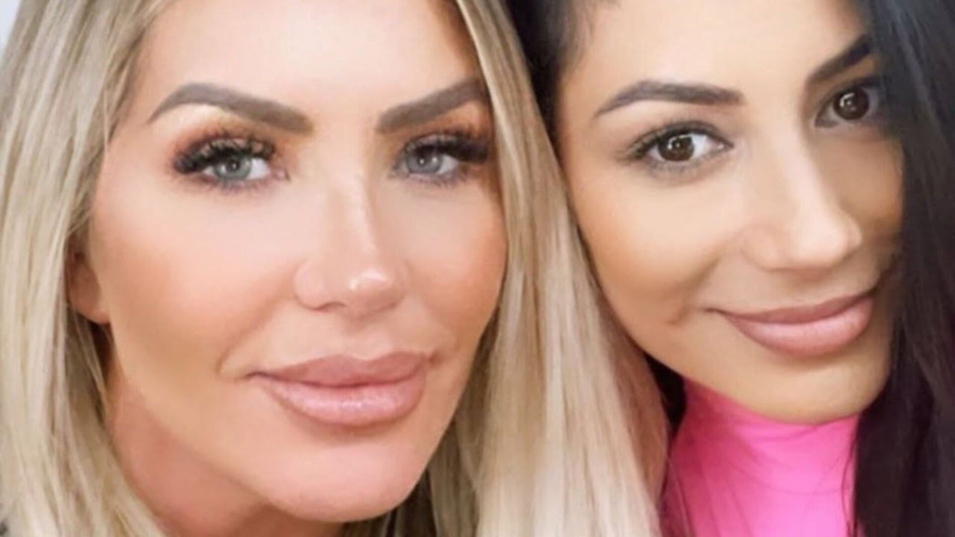 Video thumbnail for Stunning Plastic Surgery Transformations From Athletes' Wives