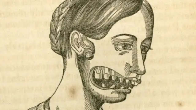 'Video thumbnail for What Happened To The Bodies Of The Radium Girls?'