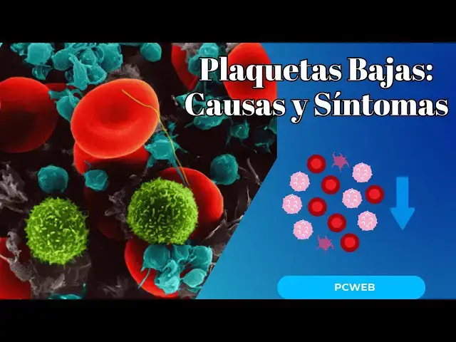 Video thumbnail for Plaquetas Bajas: Causas, Síntomas y Cómo Mejorarlas Naturalmente
