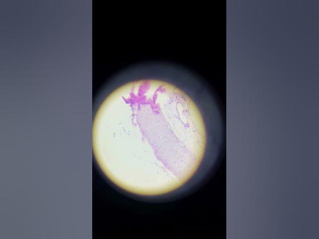 Video thumbnail for Hyaline cartilage under microscope #microbiology #cellbiology #infectiousdiseases