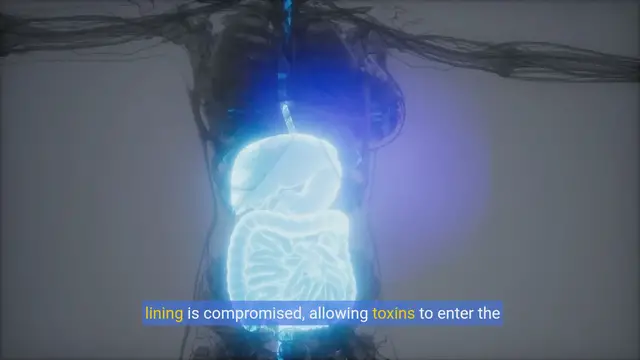 Video thumbnail for Unveiling Leaky Gut Syndrome: Causes, Symptoms, and Treatments (1)