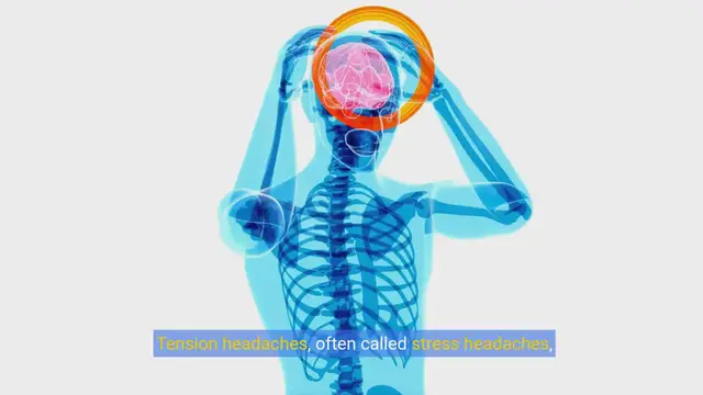 Video thumbnail for Unlocking Relief Understanding and Managing Tension Headaches