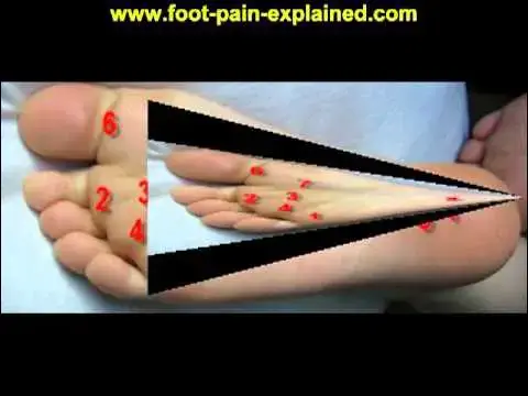 Video thumbnail for ball of foot pain